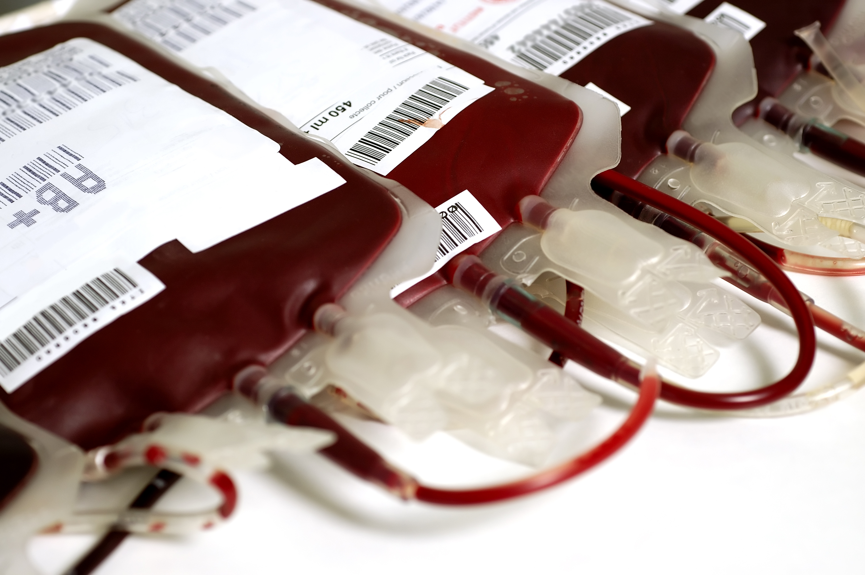 Эритроциты донора. Гемотрансфузия плазмы крови. Контейнер для переливания крови.
